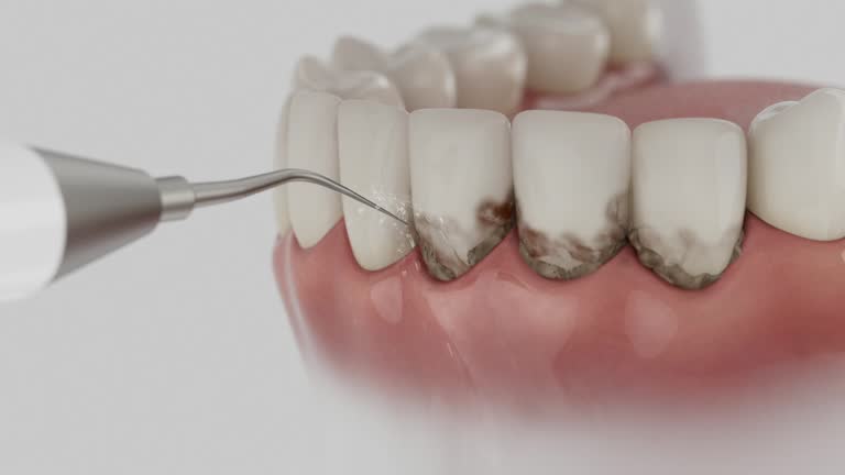 Trusted Dental Crowns And Bridges service in Johnsonburg, PA - Dentist Open Now